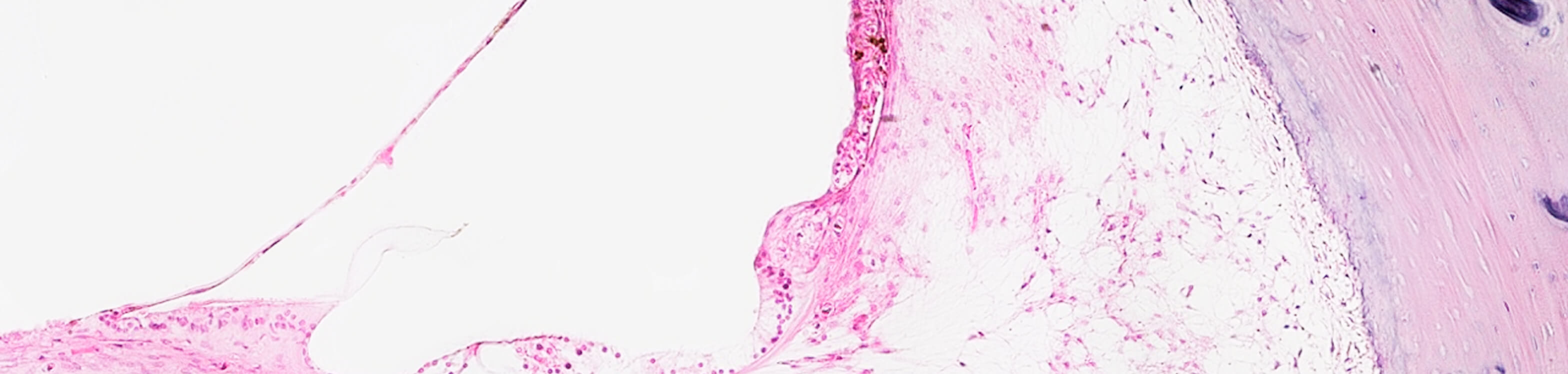 Histology image (pink on cream background)