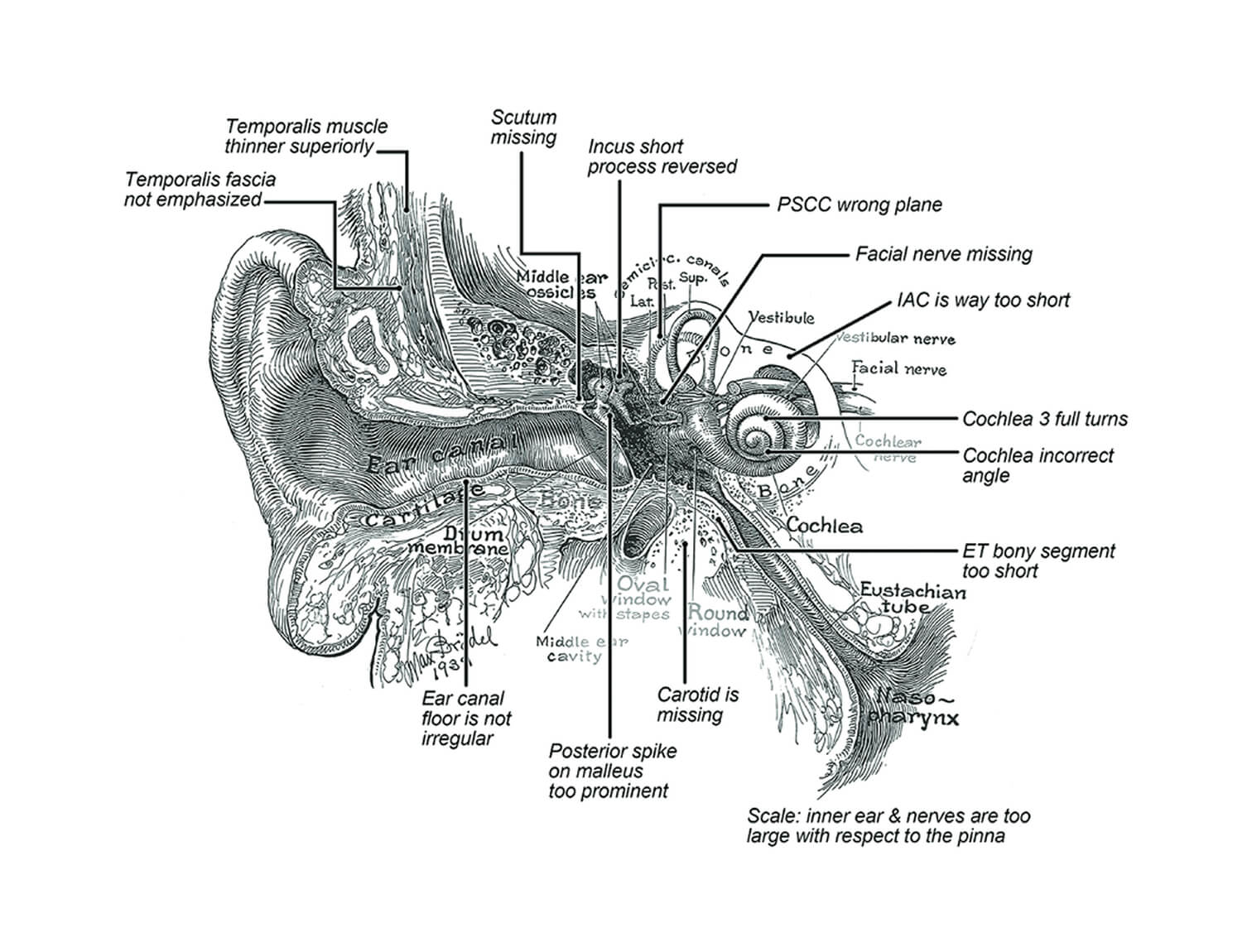 Illustration of human inner ear with various labels - Max Brödel’s 1939 Classic Coronal Illustration of the Inner Ear